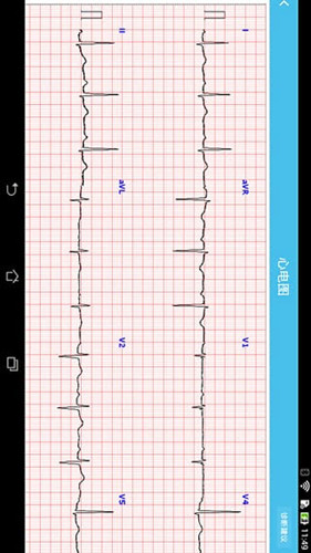 远程心电监护软件开发功能特点